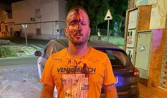 Agreden a un vecino de Totana y le ocasionan varias heridas en la cabeza al grabar un bar que supuestamente infringía la normativa