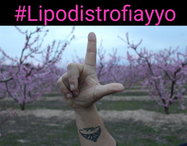 Arranca la campaña de visibilidad en redes sociales del Día Mundial de las Lipodistrofias