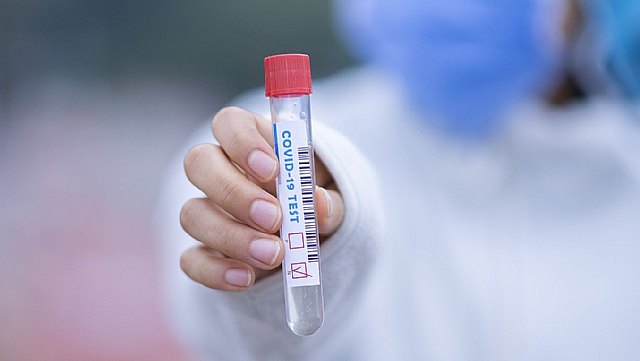 Totana suma 22 nuevos casos de Covid-19 en las últimas 24 horas