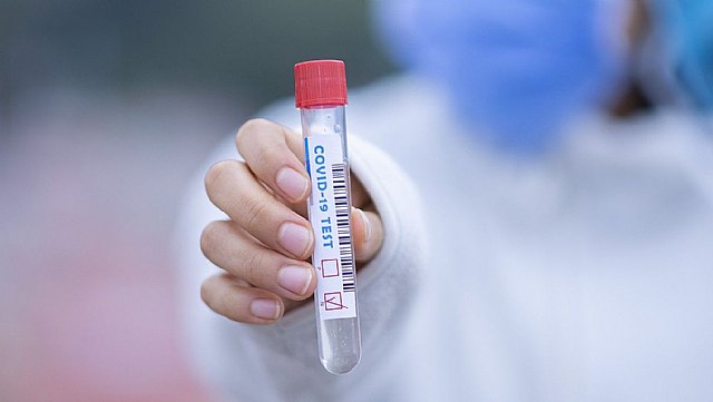 Servicio de Epidemiología confirma 13 nuevos casos positivos de por Covid-19 en Totana
