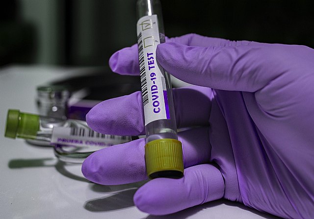 La Región de Murcia ha registrado 352 nuevos contagios por coronavirus, 11 en Totana